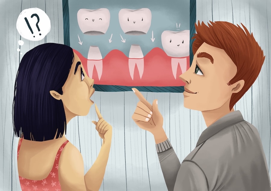 illustration of dental crowns